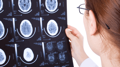 Concussions In Car Crashes Often Go Unnoticed And Unreported