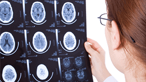 Are Head Injuries Immediately Noticeable After An Accident?