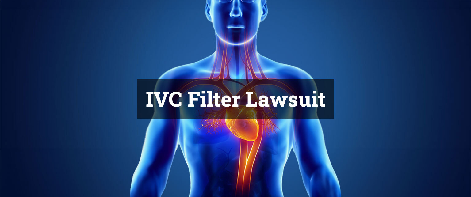 Things You Should Know About IVC Filters